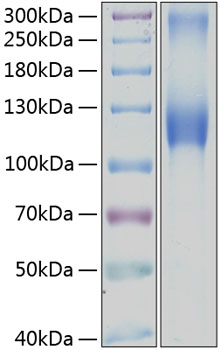 Recombinant human gpnmb protein 20 µg