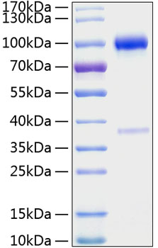 Recombinant mouse osteoprotegerin/tnfrsf11b protein 100 µg