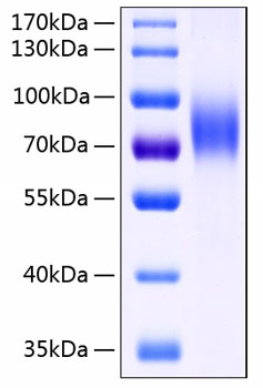 Recombinant human micb protein 100 µg