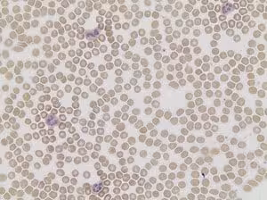 Acid phosphatase leukocyte (trap) kit 1 kit