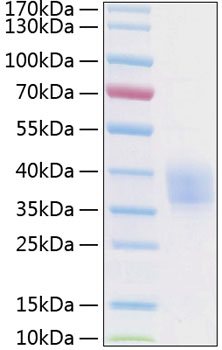 Recombinant human epcr/cd201/procr protein 20 µg