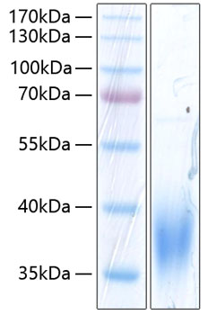 Recombinant human slamf7/cd319 prot ein 500 µg