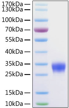 Recombinant human fc gamma riib/c p rotein (cd32,cd32b,fcg2,fcgr2,igfr2) p31994 50 µg
