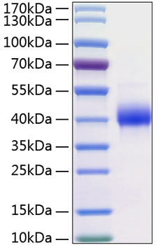 Recombinant human klk11/kallikrein- 11 protein 20 µg