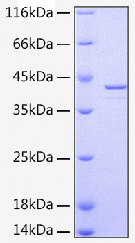 Recombinant human lrpap protein 10 µg