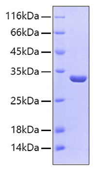 Recombinant human sult1a1 protein 100 µg