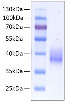Recombinant human coagulation facto r iii/tissue factor/cd142 protein 50 µg