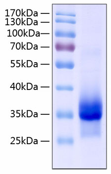 Recombinant human igfbp-4 protein 100 µg