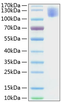 Recombinant human ceacam-5/cd66e pr otein 20 µg