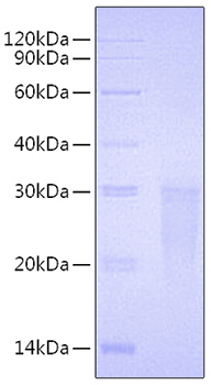 Recombinant human tmigd2/igpr1 prot ein 1000 µg
