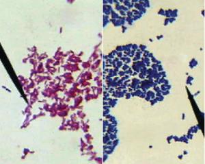 Bacterial gram staining 1 KIT