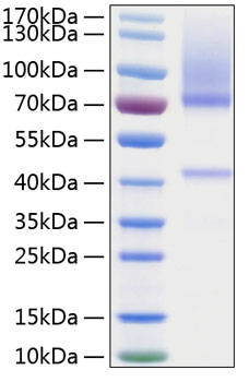 Recombinant human glypican 3 protei n 20 µg