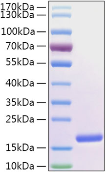 Recombinant human fabp5 protein (e- fabp, efabp, kfabp, pa-fabp, pafabp) q01469 10 µg