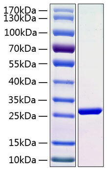 Recombinant human c-reactive protei n protein 50 µg