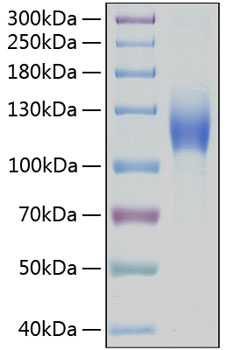 Recombinant human kit/c-kit/cd117 p rotein 50 µg