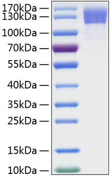 Recombinant human osmr protein 100 µg