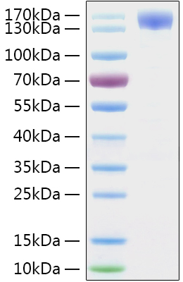 Recombinant 2019-ncov spike s1 prot ein with fc andhis tag 100 µg
