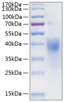 Recombinant human ifngr1/cd119 pro tein 20 µg