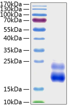 Recombinant human ctgf protein 10 µg