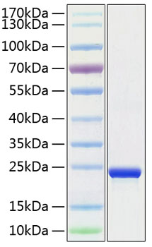 Recombinant human tmpo protein (cmd 1t, lap2, lemd4, pro0868, tp) p42166 500 µg