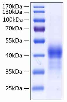 Recombinant human sftpd/sp-d/sftp4 protein 20 µg