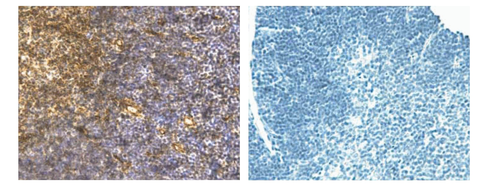 Zinc fixative ihc 1 l