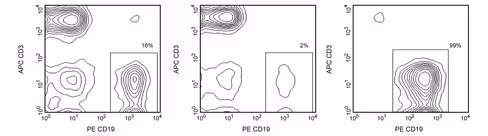 Hum.cd19 imag part.dm 1 x 2 x 109 cells