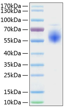 Recombinant human st2 protein 100 µg