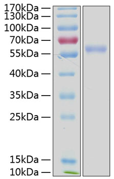 Recombinant human ulbp-3 protein 100 µg