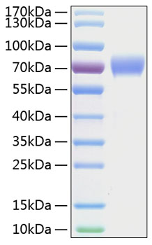 Recombinant human axl protein 50 µg