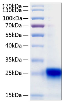Recombinant human ifnl3/il28b/inter leukin-28b protein 50 µg