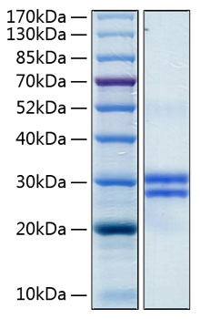 Recombinant human jam-a protein 20 µg