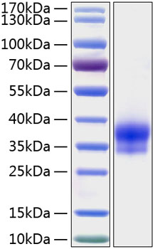 Recombinant human igfbp6/ibp-6 prot ein 500 µg