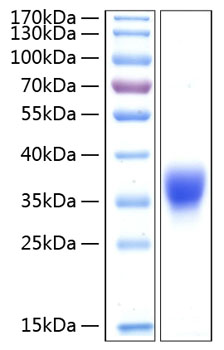 Recombinant human btn1a1/butyrophil in protein 20 µg