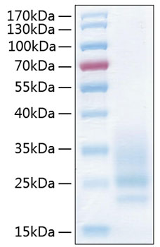 Recombinant human cd83 protein 10 µg