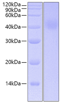 Recombinant human il-20ra/il-20 r a lpha protein 1000 µg