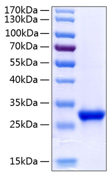 Recombinant human tetranectin prote in 50 µg