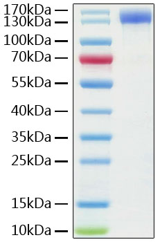 Recombinant human ace2 protein with hfc tag (ace-2,aceh,ace2) q9byf1 100 µg