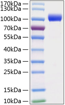 Recombinant mouse mmp-9 protein 20 µg