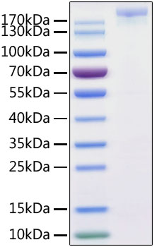 Recombinant sars-cov-2 s1+s2 ecd (s -ecd) protein with his tag (mutants introduced) (cov spike protei 100 µg