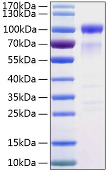 Recombinant human sirp alpha/cd172a protein 50 µg