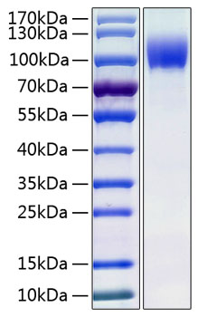 Recombinant human il13ra1 protein 10 µg