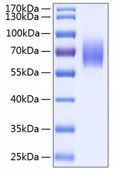 Recombinant human il18bpa protein 100 µg