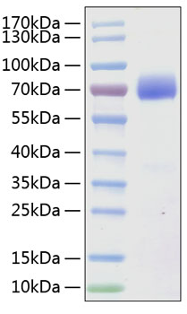 Recombinant human slamf7/cracc/cd31 9 protein (19a,cd319,cracc,cs1,slam7) q9nq25 50 µg