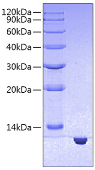 Recombinant human s100 calcium bind ing protein b/s100b protein 10 µg