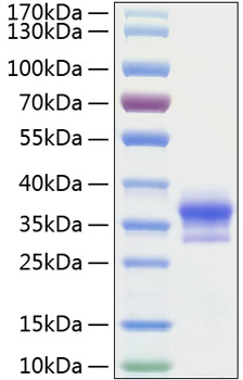 Recombinant human lox-1/olr1 protei n 10 µg