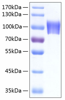 Recombinant human neuroligin 4/nlgn 4 protein 50 µg