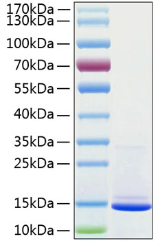 Recombinant human b2m/beta-2-microg lobulin protein 20 µg