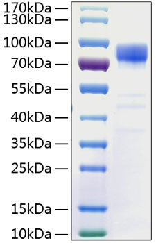 Recombinant human disks large homol og 4 protein 50 µg