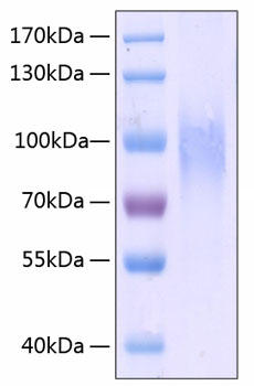 Recombinant human cd31/pecam1 prote in (cd31,cd31/endocam,endocam,gpiia,peca1,pecam-1) p16284 50 µg